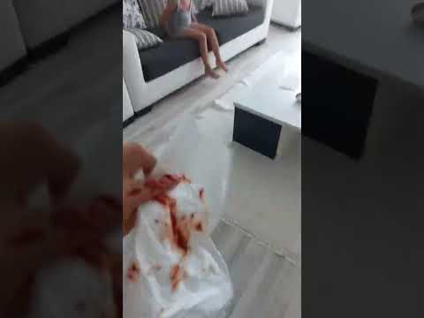 Anne elim kanadı