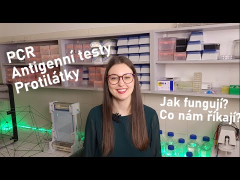 Video: Čo je funkčné testovanie v manuálnom testovaní s príkladom?