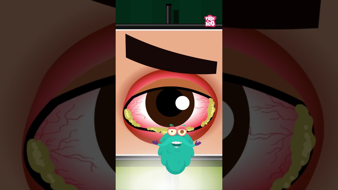 What Is Pink Eye Causes Conjunctivitis Shorts Pinkeye Drbinocsshow