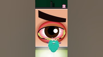 What Is Pink Eye? What Causes Conjunctivitis #shorts #pinkeye #conjunctivitis #drbinocsshow