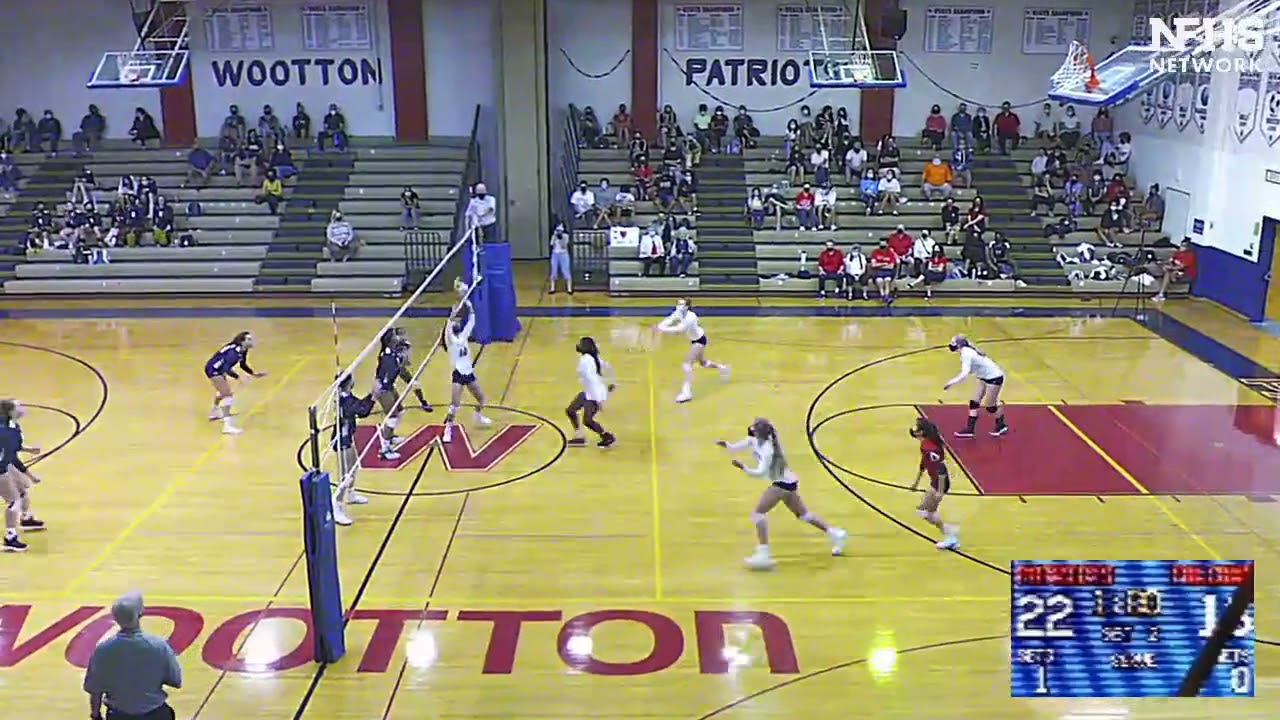 WoottonVsGC GK Clips20210923