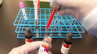Blood Banking: Antibody Screen Set up Part 1