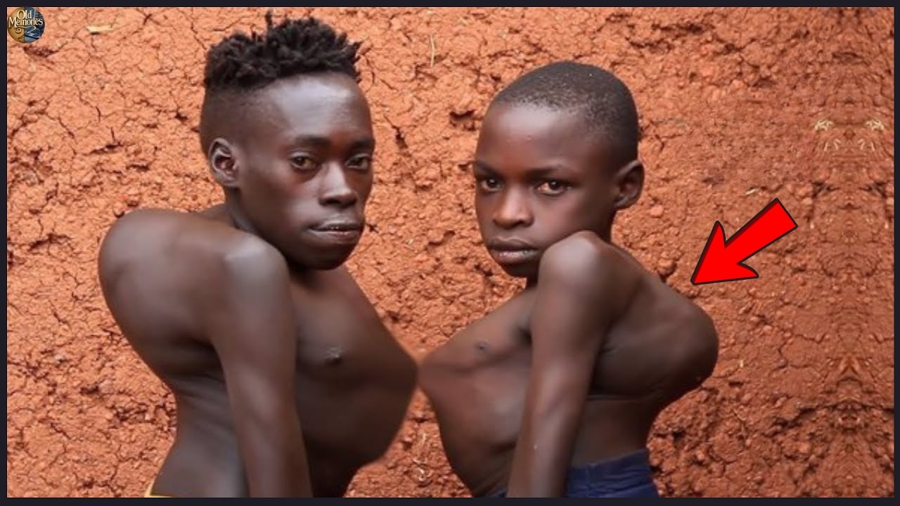 12 Black People With The Rarest Genetics In The World | Then and Now 2026