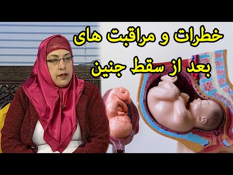 تصویری: 3 روش برای از بین بردن چسب گچ از پوست