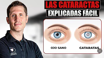 ¿Qué son los ojos errantes?