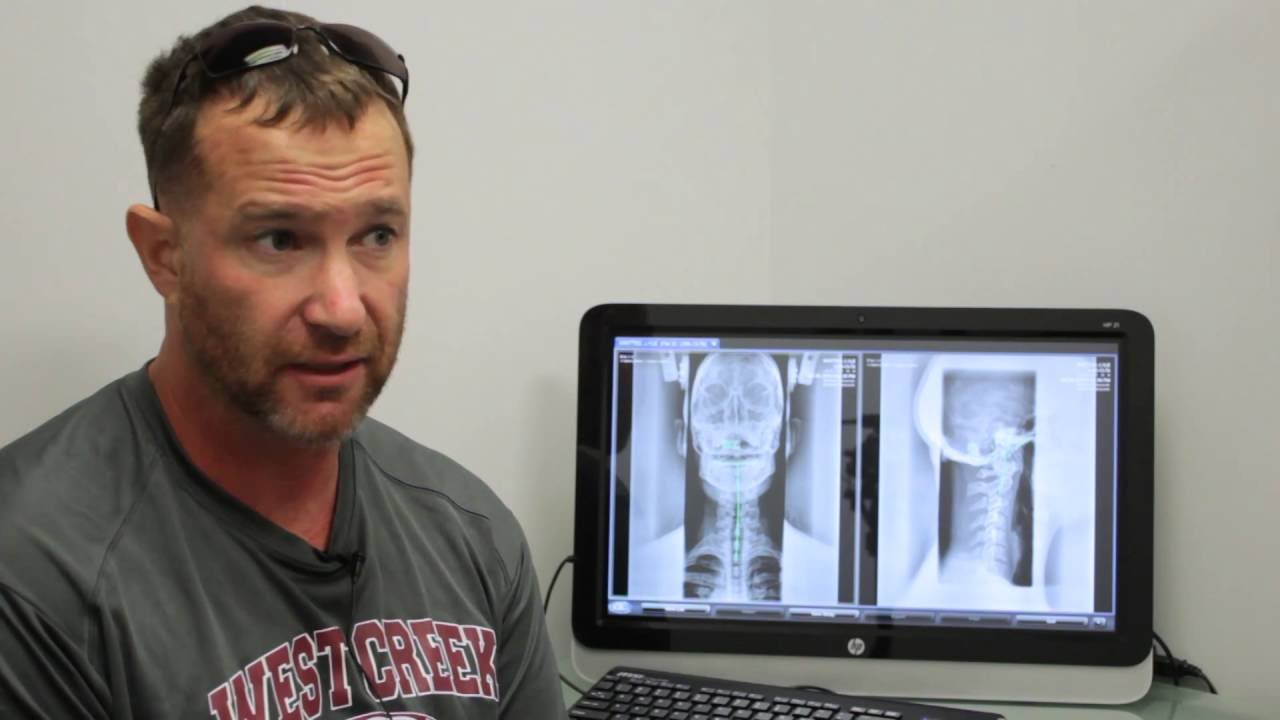 Lyle - Rheumatoid Arthritis nearly cost him his career, chiro saved it