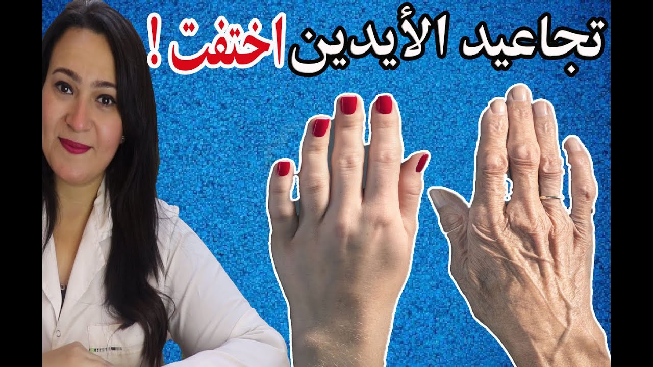 طريقة تمحى تجاعيد الأصابع و خطوط اليدين نهائيا وتصغرك 10 سنوات | تجعلها ناعمة و بيضاء ومشدودة