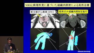 前立腺がん治療アップデート：早期･進行がんの最新治療解説　佐藤威文氏