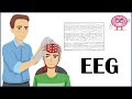 Eeg electroencephalogram  how it is done indications types of eeg  patient education