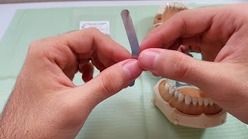 Sistema de matriz Tofflemire