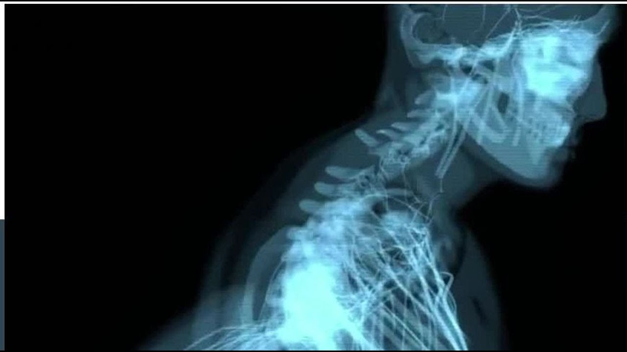 Chronic Pain with Dr. Jason Tripp - Live via OneStream Live 