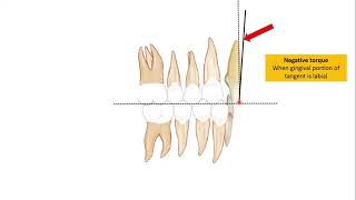 Third order bends (Torque bends)