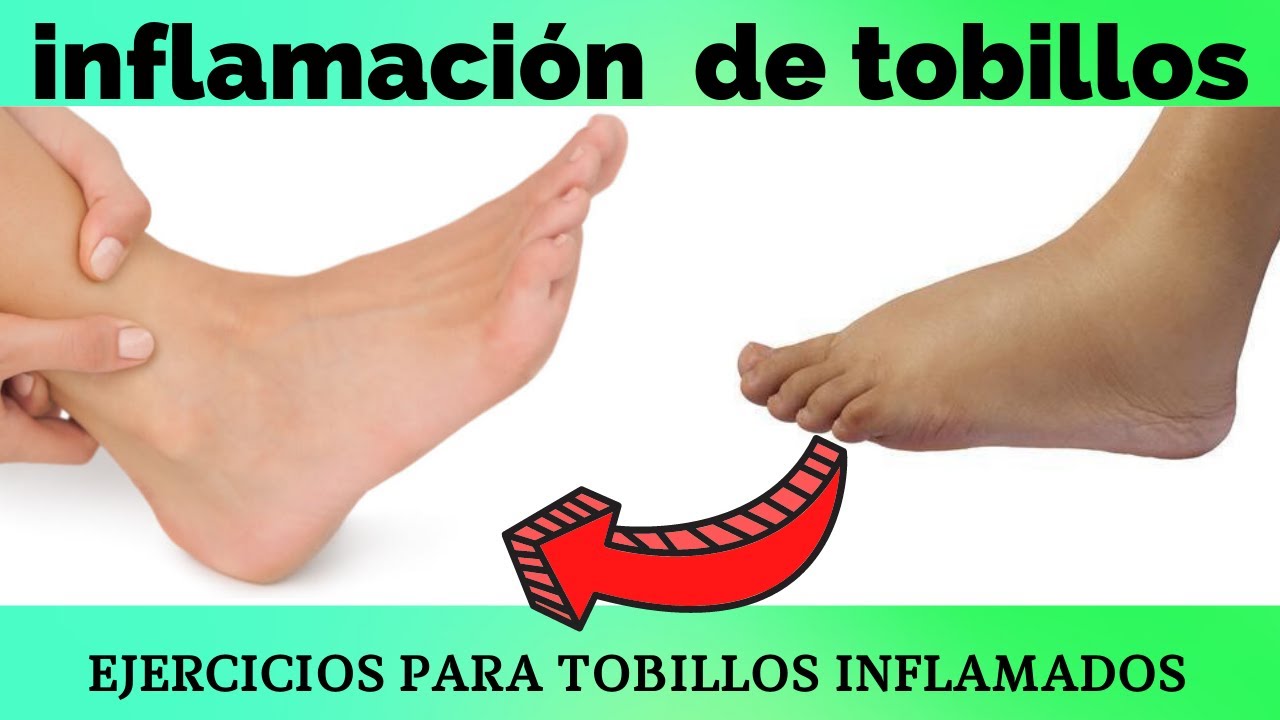 inflamación crónica de tobillo como quitarla YouTube inflamación crónica de tobillo como quitarla YouTube