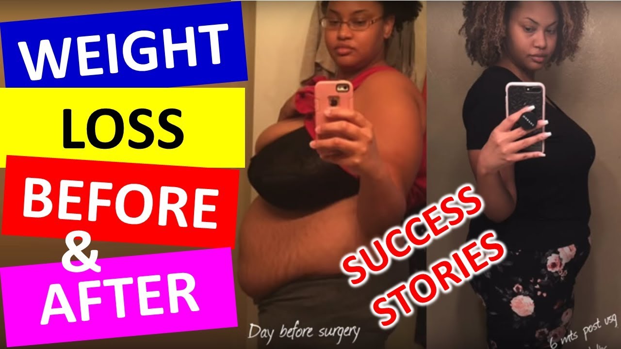 How To Lose WeightBefore and After (Success Stories) YouTube
