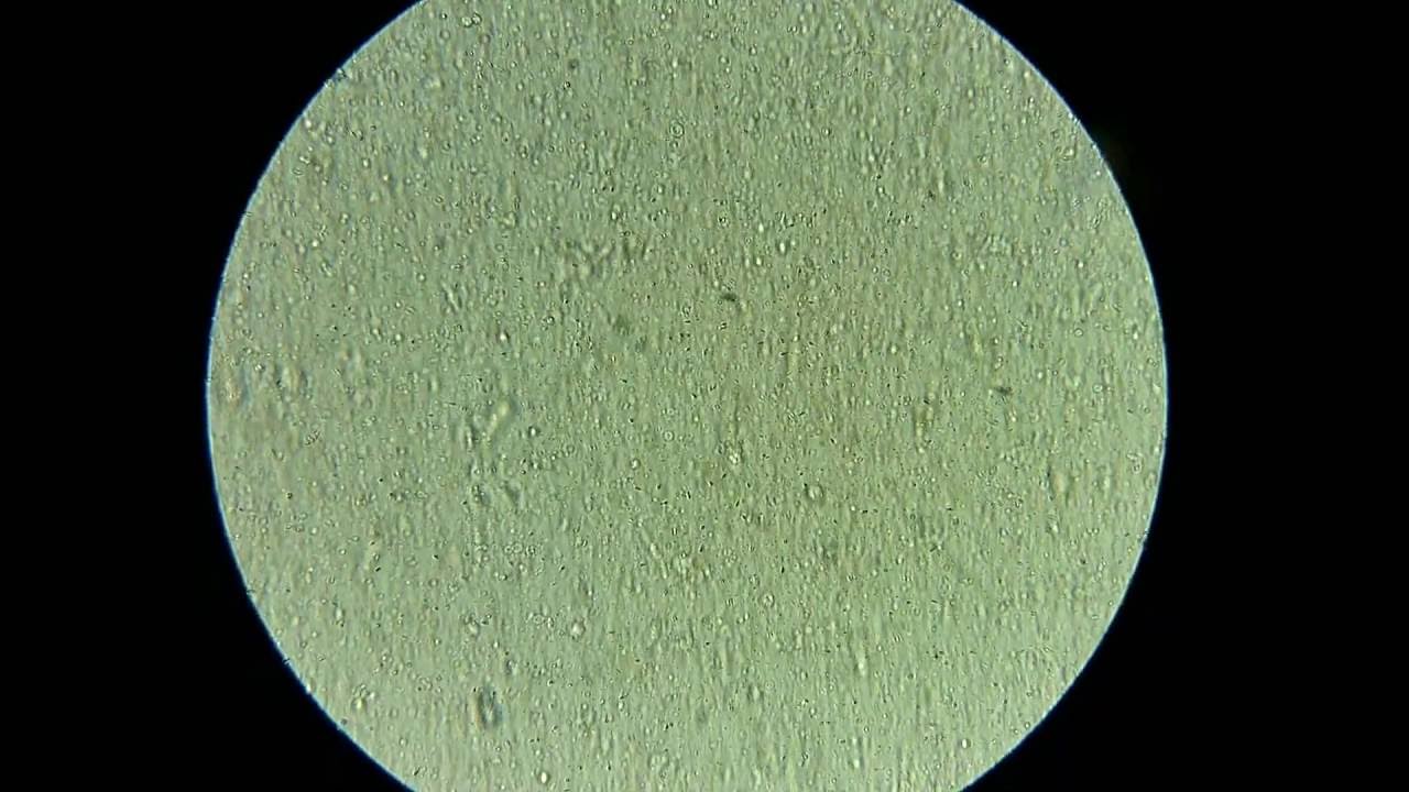 精子を顕微鏡で観察してみました