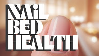 Your Nails Are Warning You! 10 Health Signs You Shouldn’t Ignore