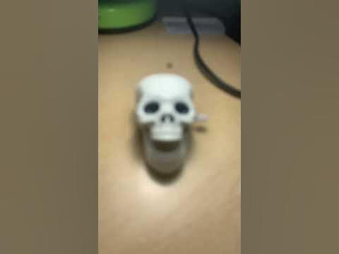 Скелет воскрес и снова попытался на меня напасть кажется он укусил меня ...