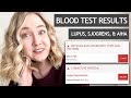 BLOOD WORK RESULTS | Lupus and Sjogrens