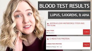 BLOOD WORK RESULTS | Lupus and Sjogrens