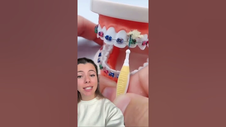 COME PULIRE bene i DENTI con l’apparecchio? 😬🦷