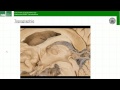 Basalganglien: Neuroanatomie Nachschlagen, Lernen, Verstehen