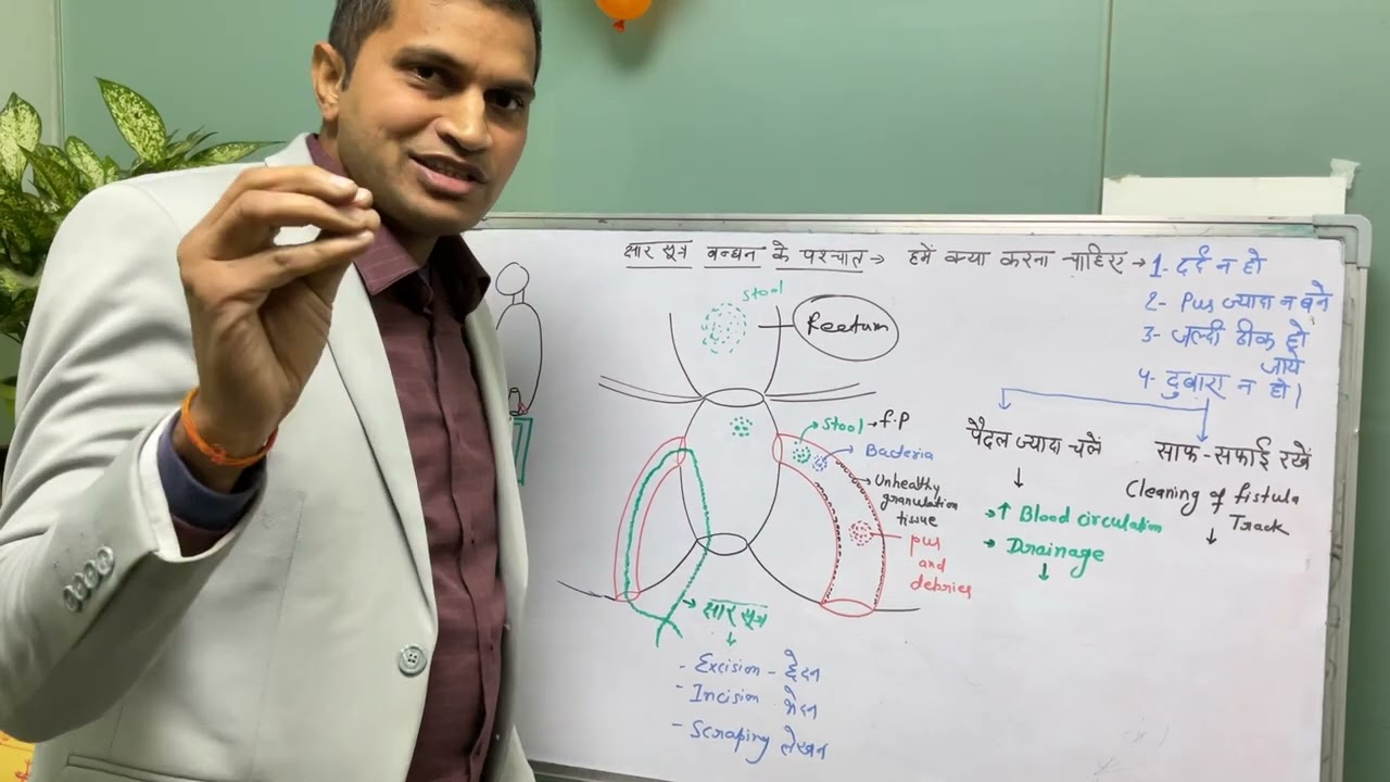 दौड़ने और टहलने एवं साफ सफाई  से फिस्टुला जल्दी ठीक होता है