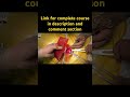 Mastering Inguinal Hernia Surgery: Lichtenstein Mesh Repair in Direct Hernia #hernia #groinhernia