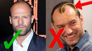 WORST Mistakes You Make When Dealing With Hair Loss