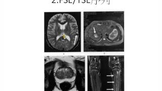 AFTYGH_RAD_MRI脈衝序列常用參數的調整_1021219