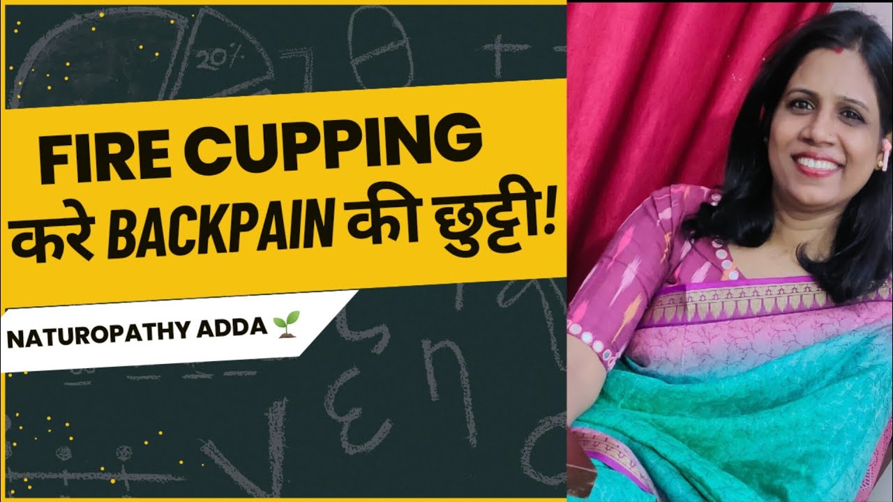 Fire cupping backpain के लिए रामबाण इलाज! leenashrigyan1726 