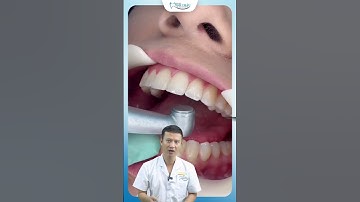 Tháo Mắc Cài Có Đau Không | Nha Khoa Minh Châu