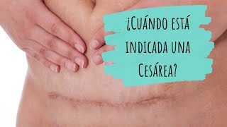 INDICACIONES para una CESÁREA · ¿Cuándo es necesaria una cesárea?