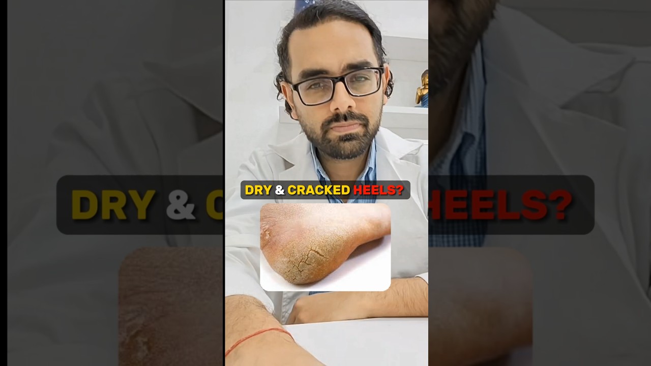 Dry & Cracked Heels? 