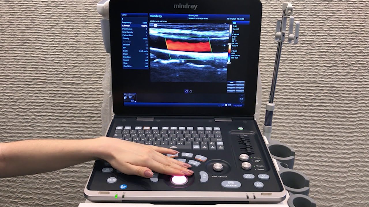 Ecógrafo Portátil Mindray Z60 | Tutorial de Instalación