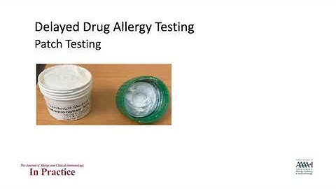 Delayed Hypersensitivity Drug Allergy Testing
