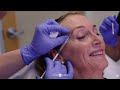 My Experience with Botox | Eyebrow Lift, Forehead, Crows Feet, Eye Wrinkle, Chin | Dr. Jason Emer