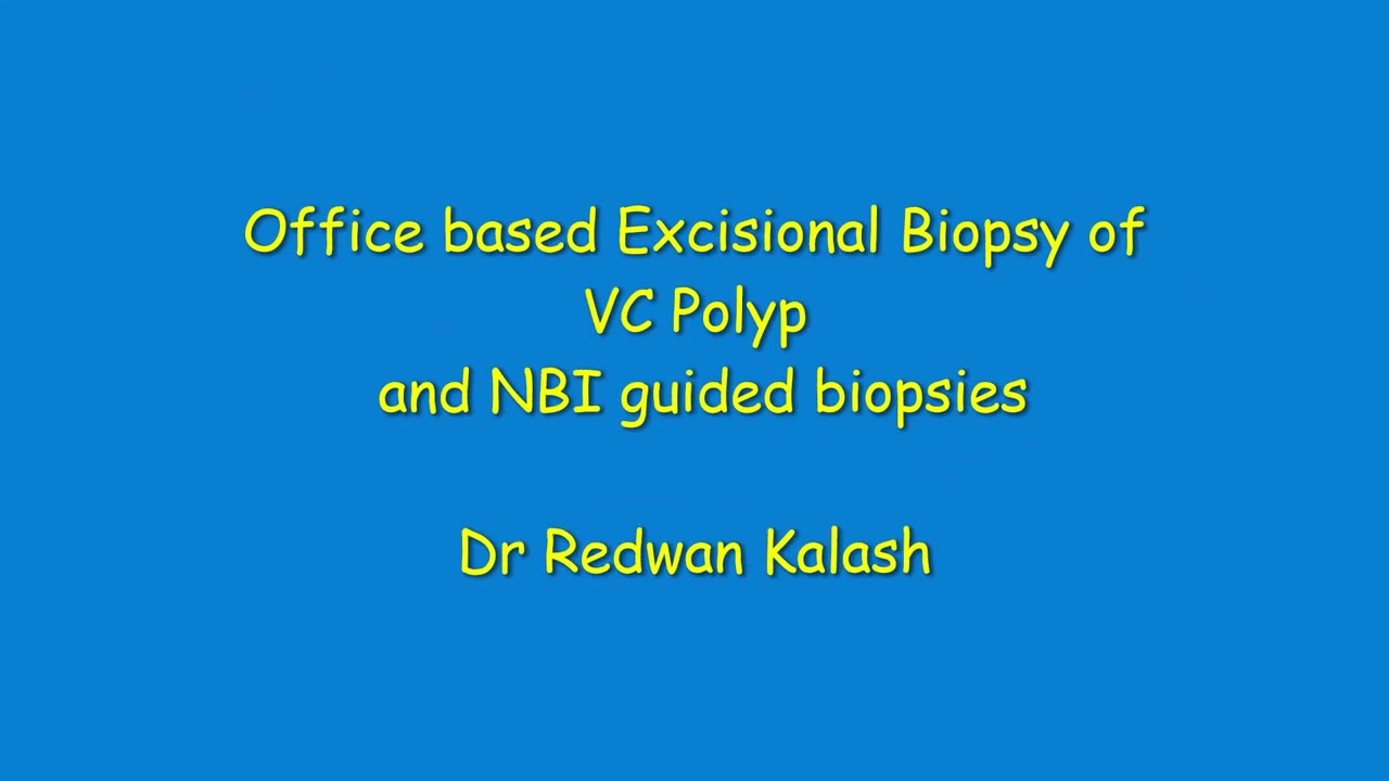 Office base Excisional Biopsy of VC Polyp and NBI guided biopsies with music