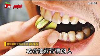 【一日醫蘋果】口腔黏膜有顆粒　應檢查 | 台灣蘋果日報