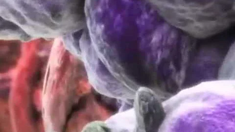 Quanti anni si vive con il tumore al colon?