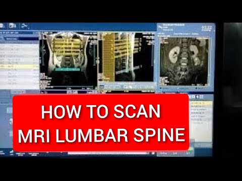  Update How to do MRI Lumbar Spine, Live Demo on GE 1.5 Tesla.