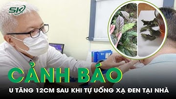 Dùng Lá Xạ Đen Điều Trị Ung Thư, Người Đàn Ông Nhập Viện Vì Khối U Tăng 12cm I SKĐS