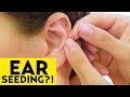 Better than Acupuncture? We Tried Ear Seeding! | The SASS with Susan and Sharzad