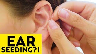 We've tried acupuncture a few times on the sass, but never done ear
seeding before! that's why we met up with mona dan at v/rituals by vie
healing to l...