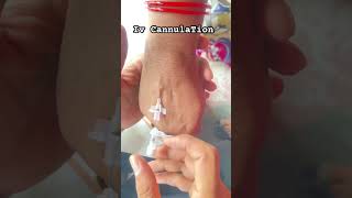 Iv CannulaTion Technique ? #CannulaTion #Short
