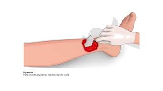 How to use PROMOGRAN and PROMOGRAN PRISMA screenshot 3