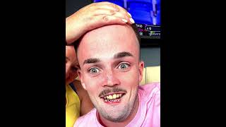 Famous Big forehead filter moments…😳 Wealth