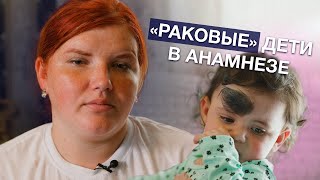 ПИГМЕНТНЫЙ НЕВУС | История Раяны Михайловой