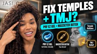Masseter Botox for TMJ and Jaw Clenching (Plus Temple Filler)
