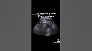 28 weeks 2D Ultrasound #jerbearimaging #ultrasound #baby #28weekspregnant