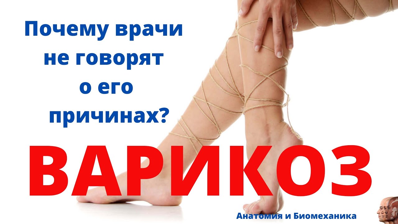 Варикозное расширение вен. Причины и физиология. - YouTube